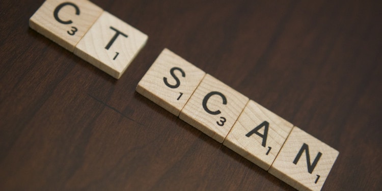 Over-Testing with CT Scans in the Emergency Department