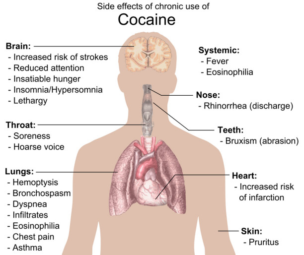 Effect of cocaine 6970022_orig