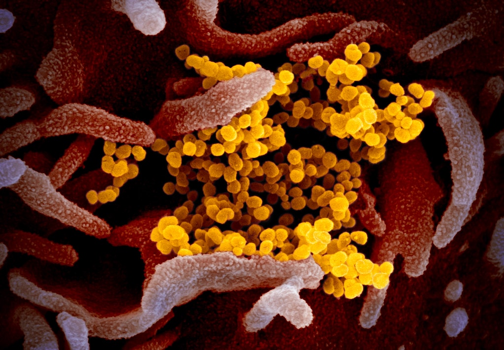 Scanned electron microscope image of SARS-CoV-2