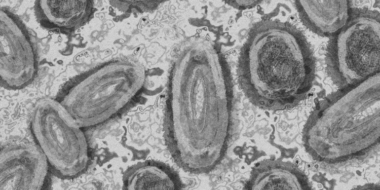 ‘Still so Many Unknowns’: An Unprecedented Outbreak of Monkeypox