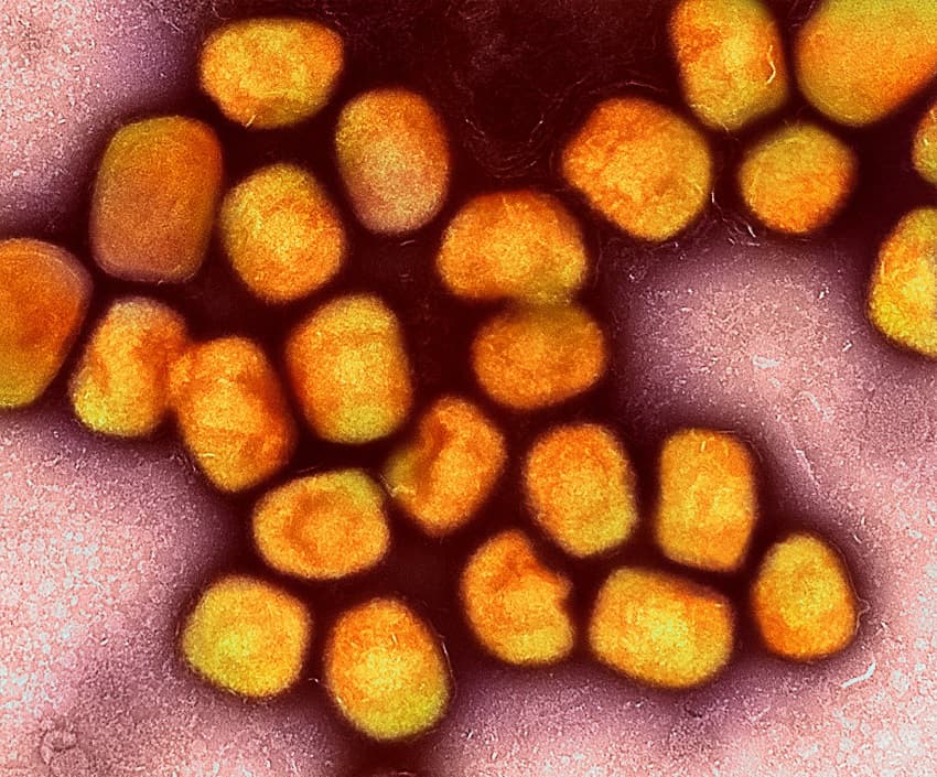 monkeypox virus