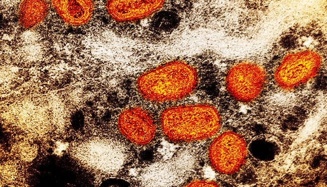 WHO Is Asking the Public for Help to Rename the Monkeypox Virus to Prevent Stigma