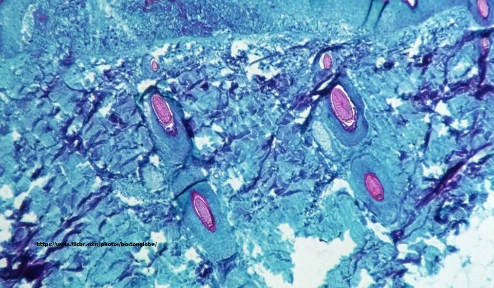 Is One Health at a Turning Point?