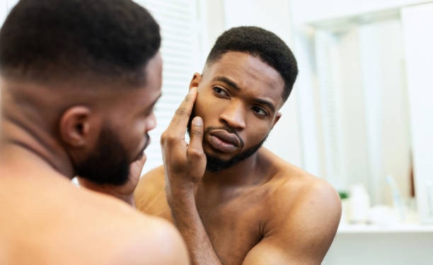 Acne problem. Young african american guy checking his face skin in mirror, free space