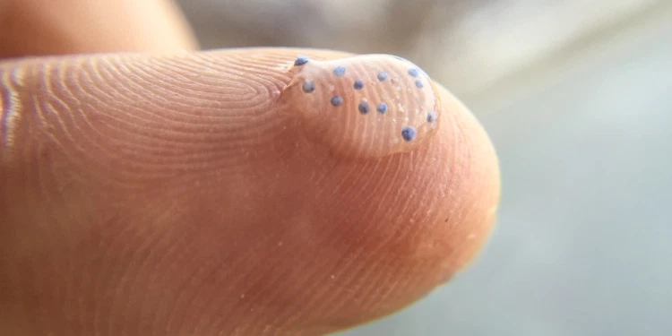 Microplastics in humans