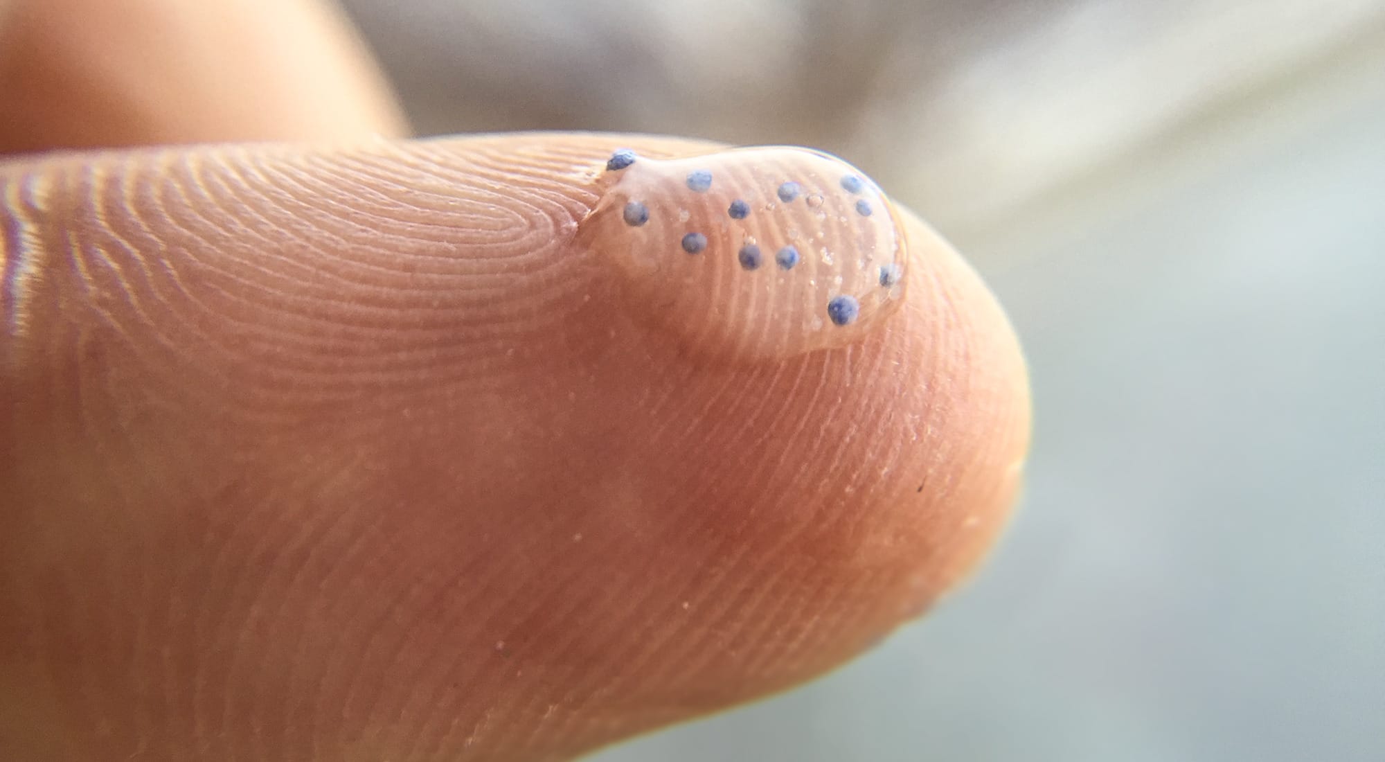 Microplastics in humans