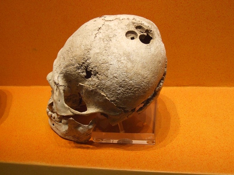 Surprising Early Medical Practices Still Relevant Today