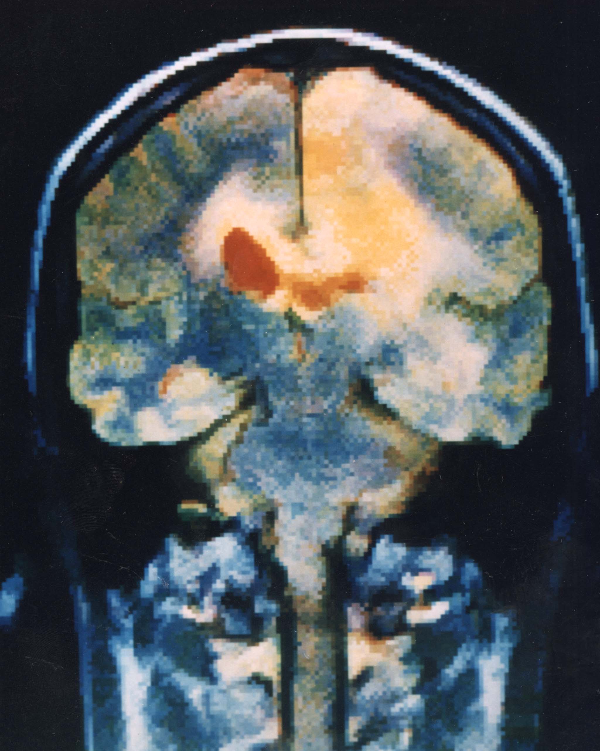 What Can AI Decode From Human Brain Activity?