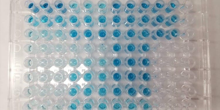 Five Major Advantages of ELISA Plate Readers