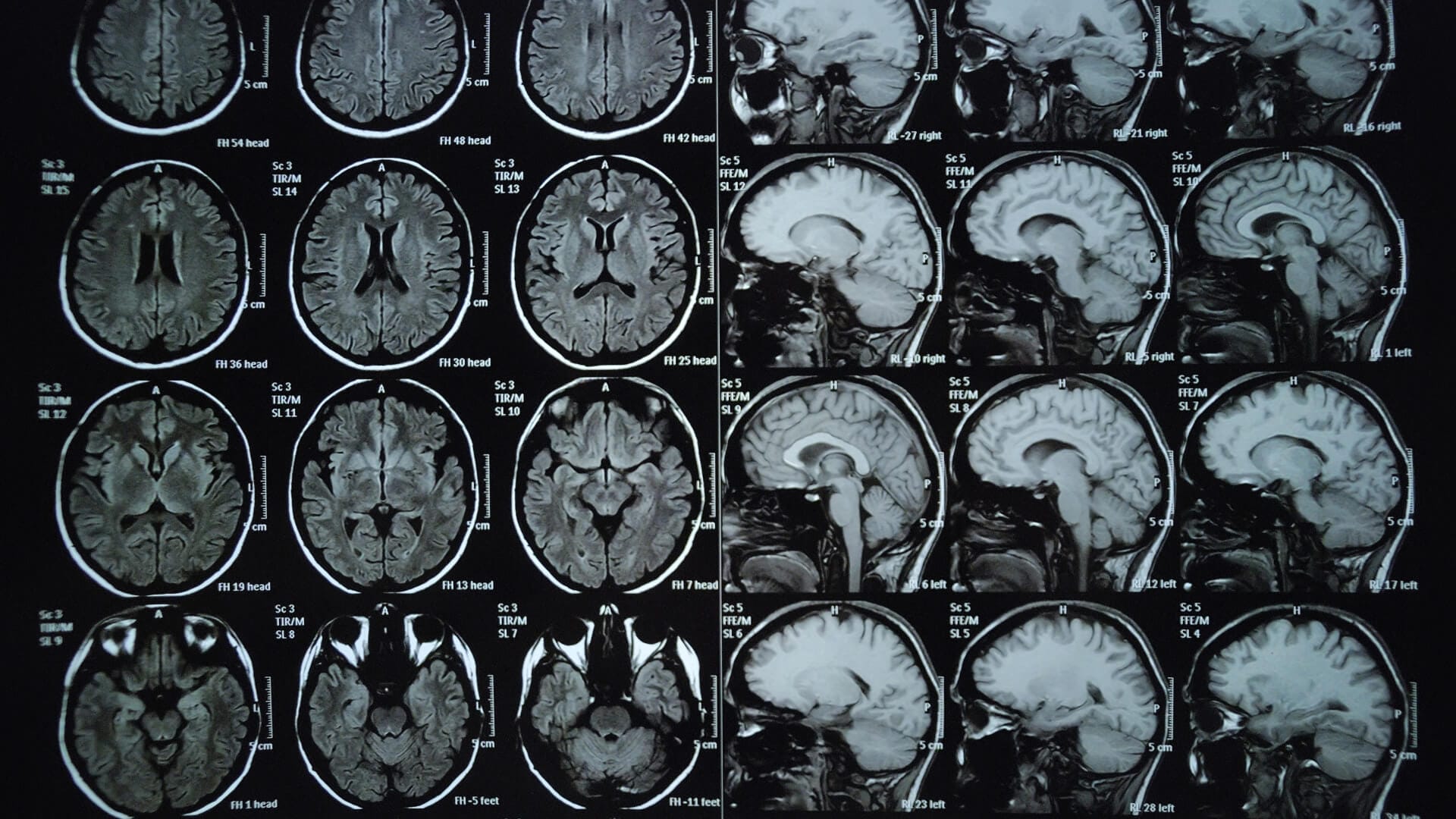 climate change brain