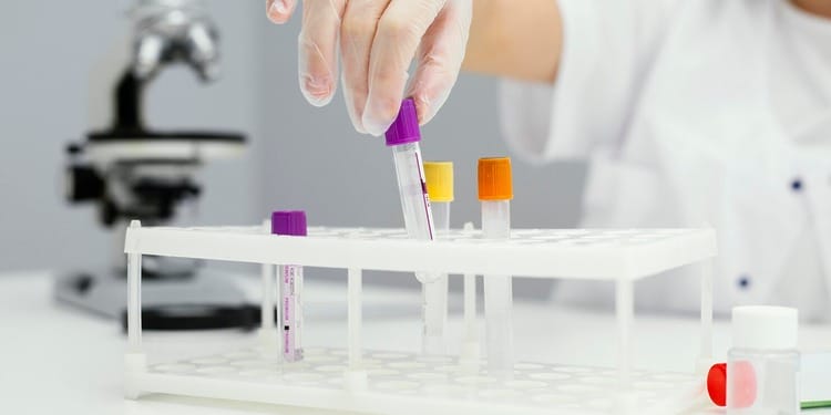 How a girl wearing a lab coat is organising the lab test samples