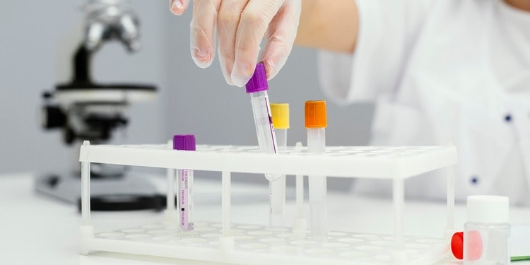 How a girl wearing a lab coat is organising the lab test samples
